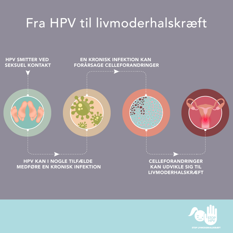 fra HPV til livmoderhalskræft