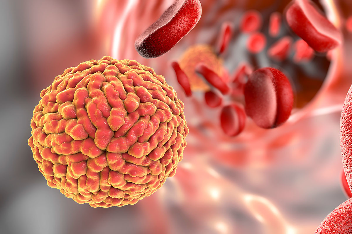Zika : des complications neurologiques émergentes pour un virus émergent