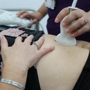 Après 50 ans, penser à dépister un anévrysme de l’aorte abdominale lors d’une échographie cardiaque