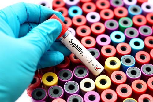 Syphilis de la femme enceinte : une augmentation nette de la prévalence aux Etats-Unis