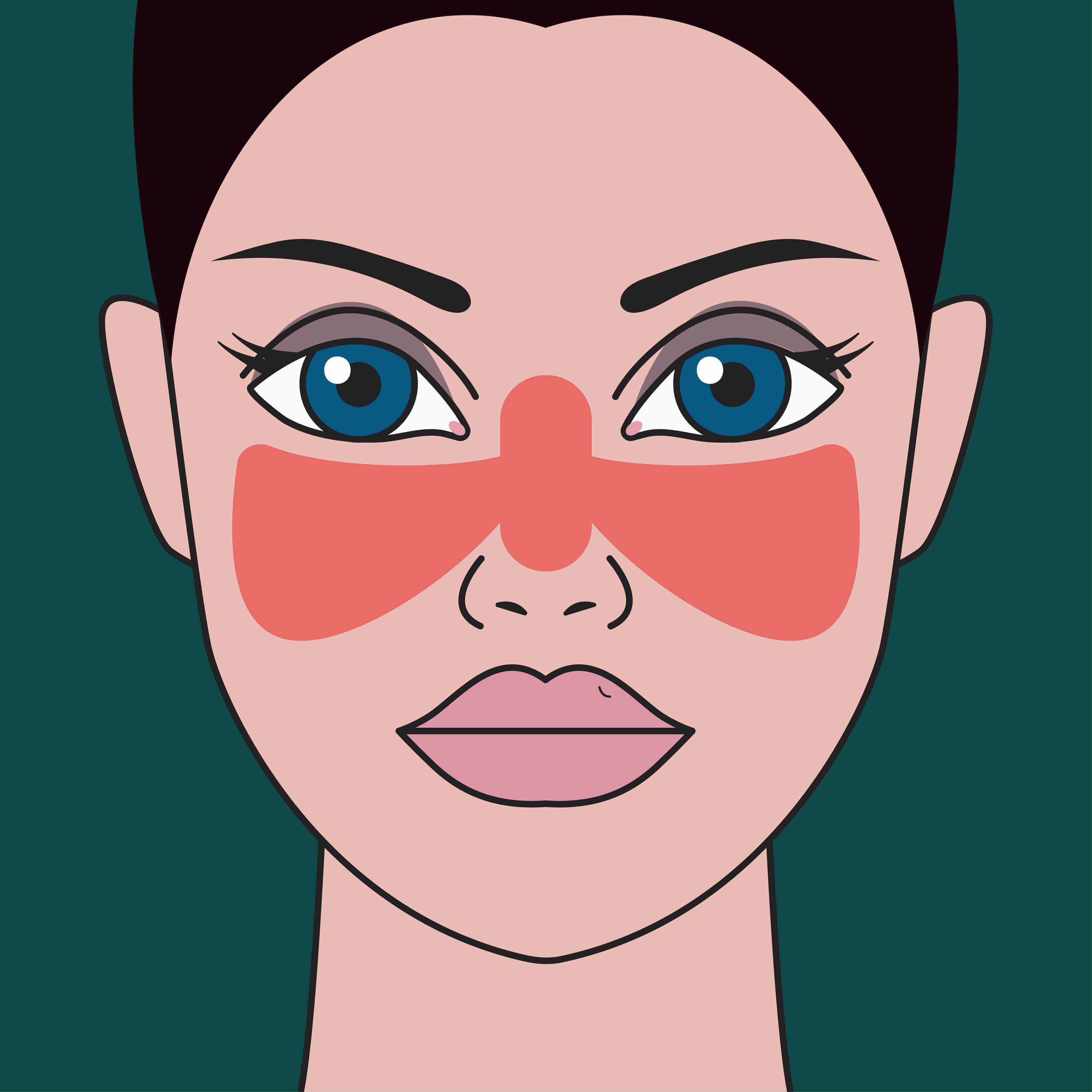 Un microbiote déséquilibré dans le lupus érythémateux systémique