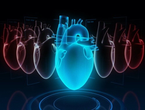 Insuffisance cardiaque de la cardiomyopathie hypertrophique chez la femme