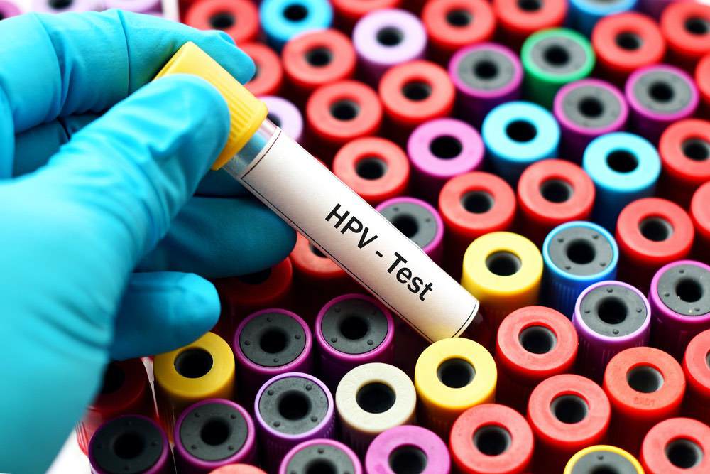 Remplacement du frottis par le test HPV pour le dépistage organisé : premiers résultats aux Pays-Bas