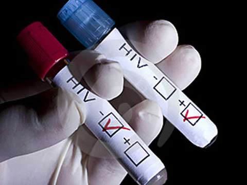 xet-nghiem-hiv-o-dau