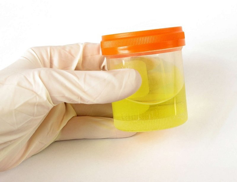 vicare.vn-xet-nghiem-hiv-bao-nhieu-tien-body-2