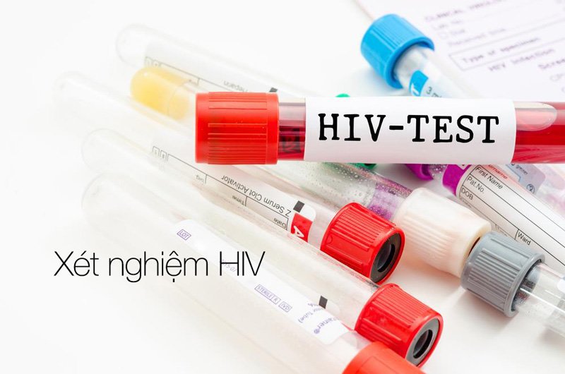 vicare.vn-xet-nghiem-hiv-bao-nhieu-tien-body-1