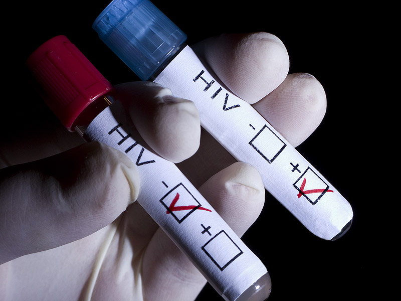 vicare-7-dia-chi-xet-nghiem-hiv-mien-phi-tai-tp-ho-chi-minh-body-2