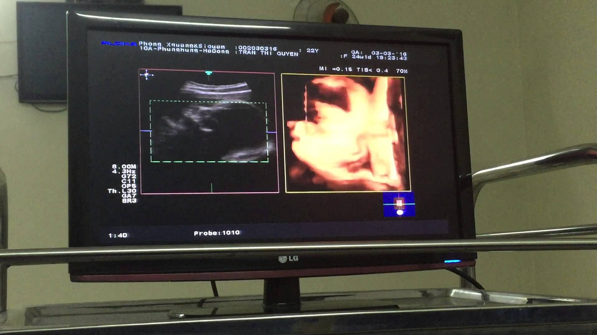 phòng khám thai uy tín ở hà đông
