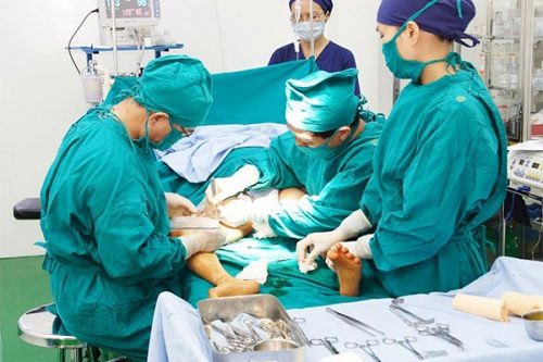 CHI PHÍ PHẪU THUẬT CẮT TRĨ