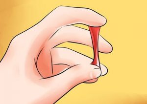 Ung thư âm đạo cũng dễ bị ngứa vùng kín nữ
