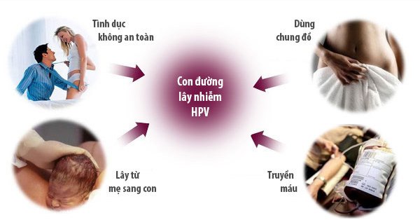 Hình ảnh bệnh sùi mào gà giai đoạn đầu tiên