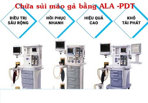 Phương pháp ALA - PDT hiện đại trong điều trị sùi mào gà