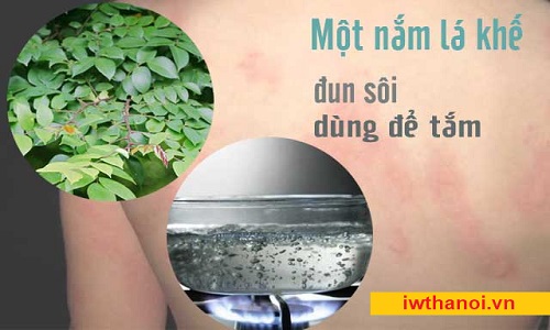 Bài thuốc Nam chữa viêm da cơ địa bằng Đông y theo dân gian