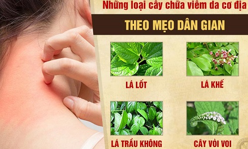 Viêm da đầu cơ địa gây đỏ, ngứa và cách chữa bệnh tại nhà