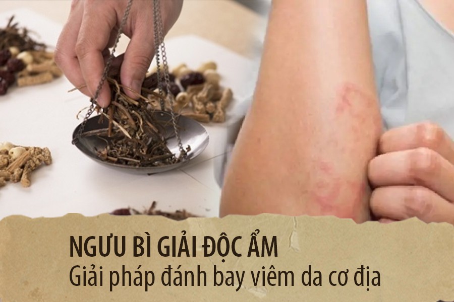 Bác sĩ chữa viêm da cơ địa, bệnh da liễu giỏi Hà Nội và TP.HCM