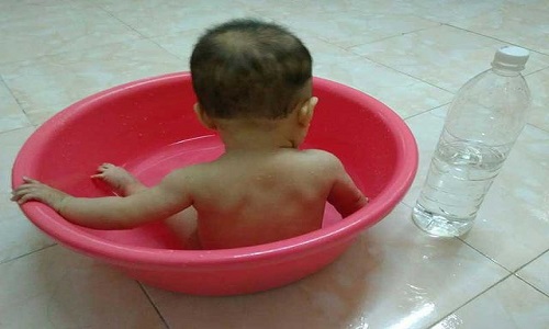 Nước Anolyte chữa viêm da cơ địa có tốt không? Tác dụng và cách dùng