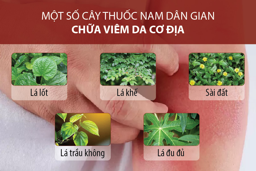 Viêm da cơ địa là gì? Triệu chứng, nguyên nhân và cách chữa trị tại nhà