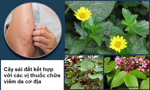 Cây sài đất chữa viêm da cơ địa: Tác dụng và cách tắm lá
