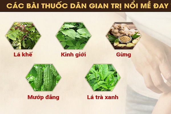 Nổi mề đay khi mang thai 3 tháng đầu, tháng cuối và cách xử lý