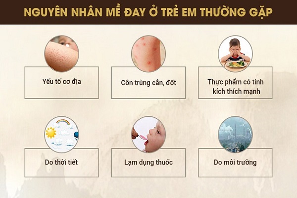 Nổi mề đay ở trẻ em: Nguyên nhân, biểu hiện và cách chữa tốt nhất cho bé
