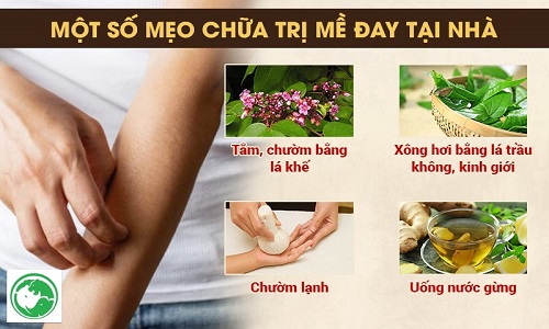 10 cách trị nổi mề đay tại nhà rất hiệu nghiệm từ chuyên gia da liễu