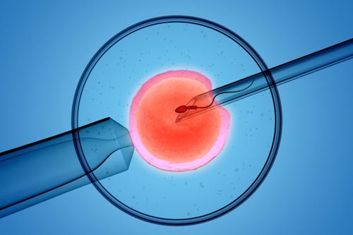 Cách tính tuổi thai IVF