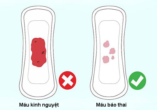 Cách nhận biết máu báo thai và máu kinh nguyệt
