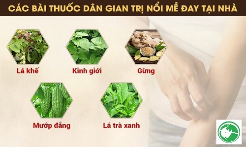 Bị nổi mề đay sau sinh bao lâu thì hết? Nguyên nhân và cách chữa