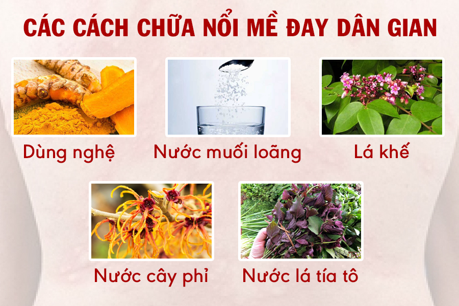 Nổi mề đay là gì? Nguyên nhân, dấu hiệu và cách chữa không tái phát