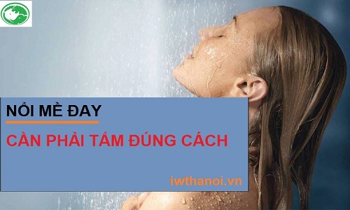 Bị nổi mề đay có được tắm không và tắm lá gì tốt nhất?
