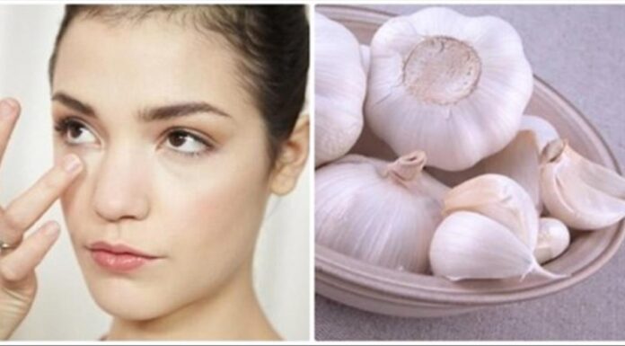 Tỏi không những tốt cho sức khỏe mà còn có thể điều trị các bệnh lý về da. (nguồn: Internet)