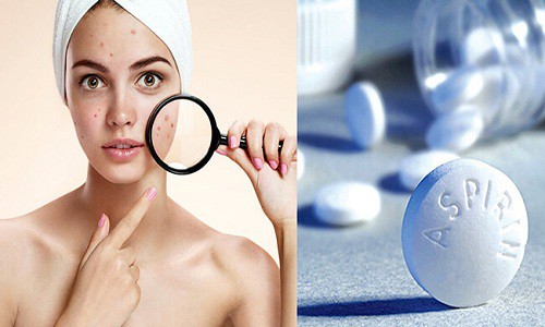 Cách trị mụn viêm đỏ không nhân, sưng dưới da tại nhà hiệu quả