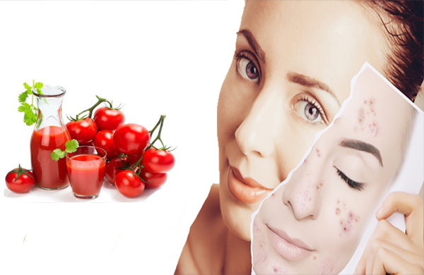 15 Cách trị mụn thâm tại nhà hiệu quả nhanh nhất cho mọi làn da - 6