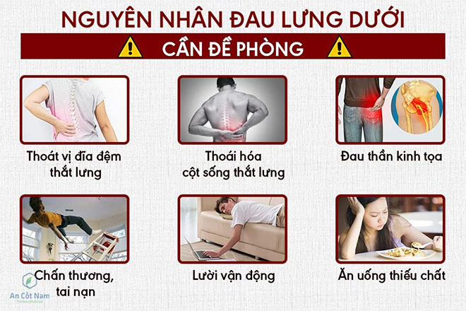 Đau lưng dưới là dấu hiệu của bệnh gì