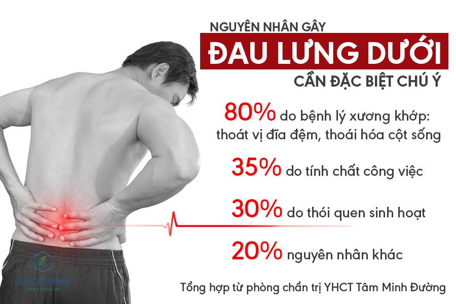 Nguyên nhân gây đau lưng dưới