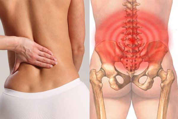 Tình trạng đau lưng dưới