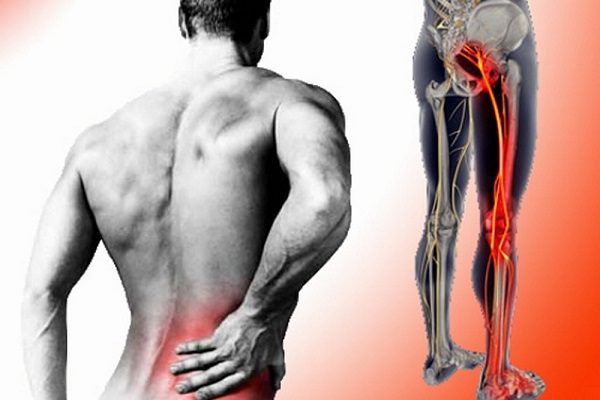 Đau lưng bên phải gần mông