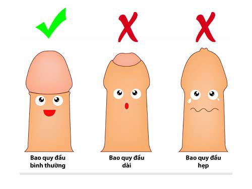 Những trường họp cần cắt bao quy đầu