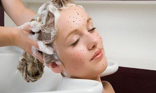 Bệnh thủy đậu kiêng gì, kiêng ăn gì, kiêng gió quạt và được gội đầu không?