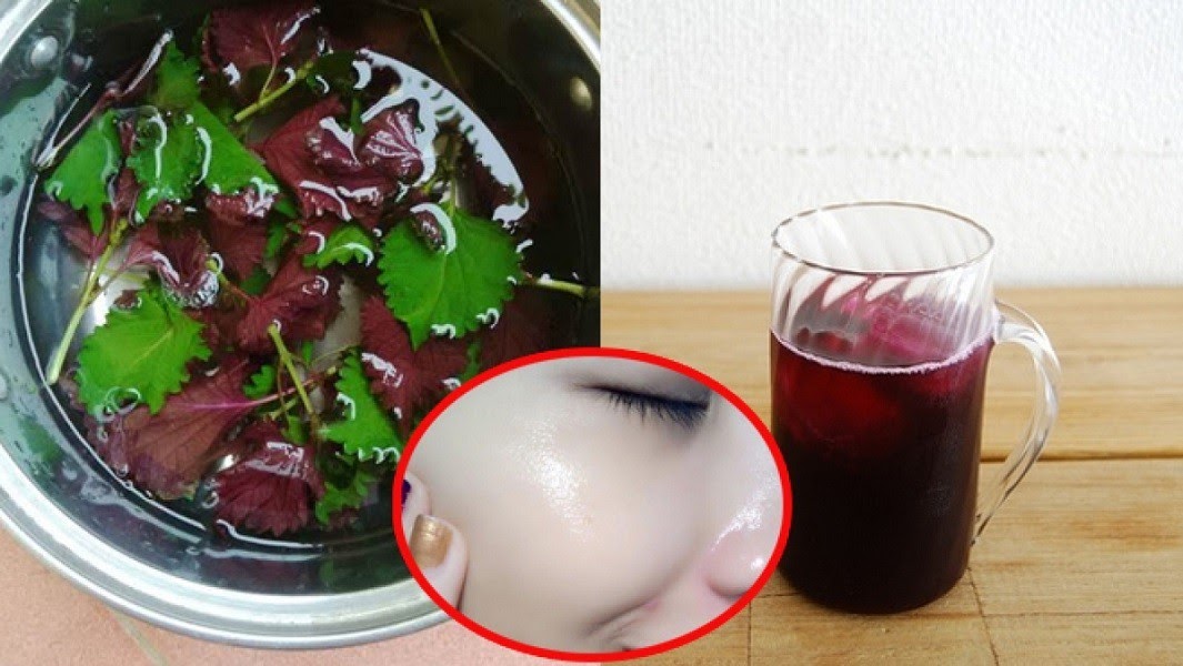 Cách trị mụn bằng lá tía tô tác dụng nhanh giúp da căng mịn sạch sẽ