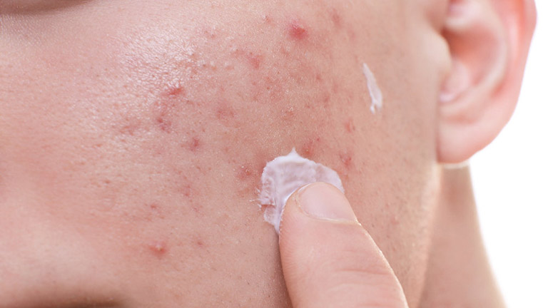 derma forte có hiệu quả không