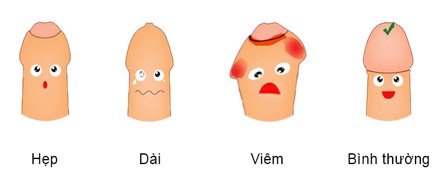 Viêm bao quy đầu có quan hệ được không