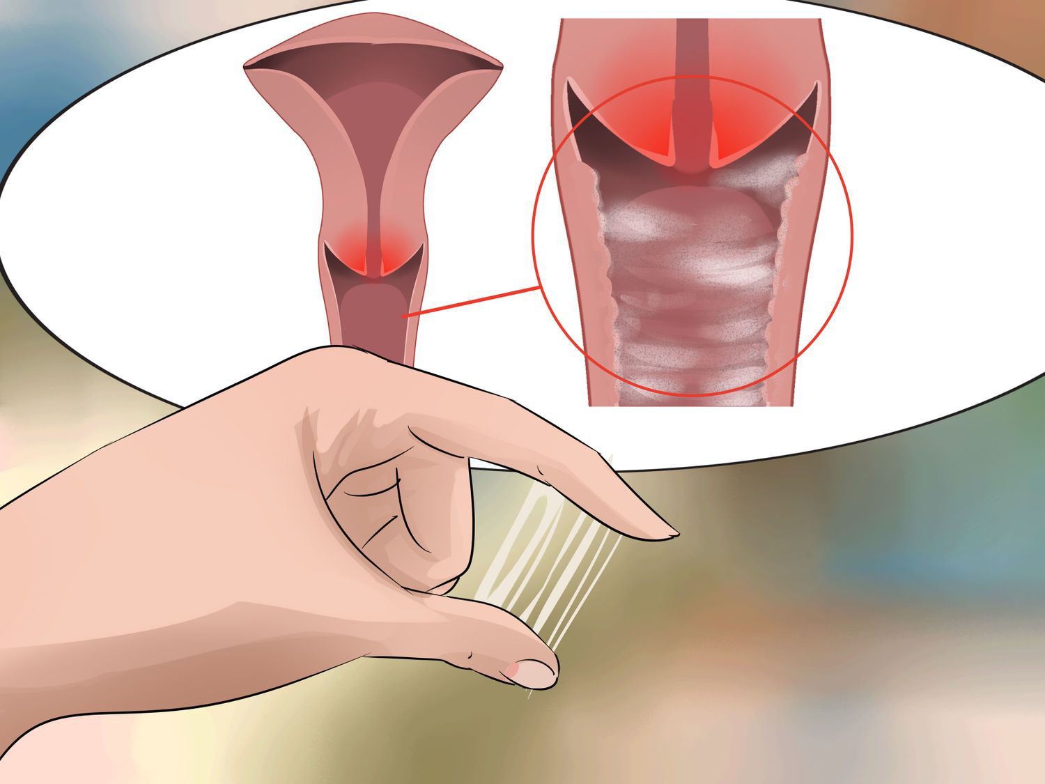 Hình ảnh bệnh phụ khoa nữ