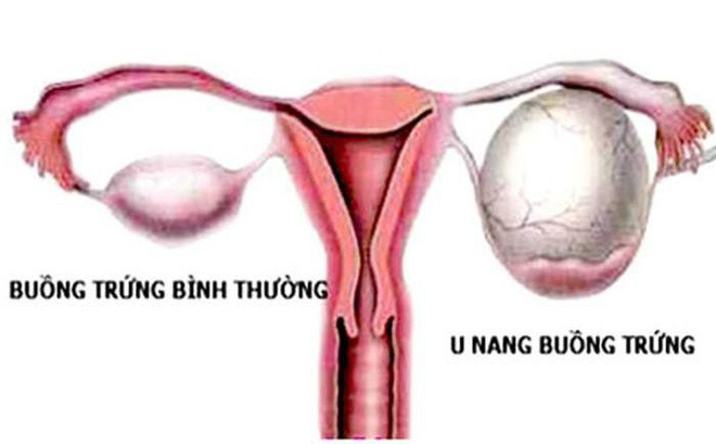 Hình ảnh bệnh phụ khoa nữ