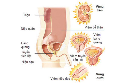 Chảy máu vùng kín do nhiễm khuẩn đường tiểu