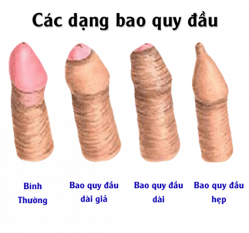 16 tuổi chưa lột bao quy đầu có sinh con được không
