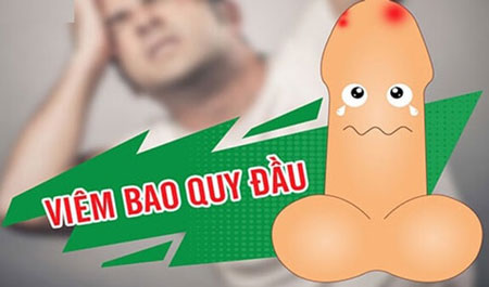 Viêm bao quy đầu cấp tính là gì