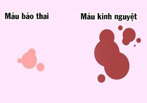 Máu báo thai ra nhiều như máu kinh có nguy hiểm không