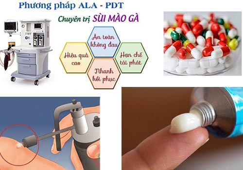 Thuốc AHPC trị sùi mào gà có hiệu quả không
