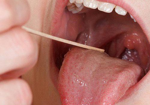 Cổ họng lúc nào cũng có đờm là bệnh gì? Cách chữa trị